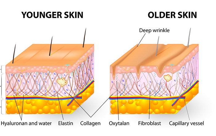 Nguyên nhân dẫn đến suy giảm Elastin
