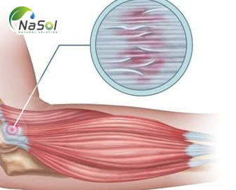 Amlexin với đau cơ khởi phát muộn (DOMS) Amlexin với đau cơ khởi phát muộn (DOMS)