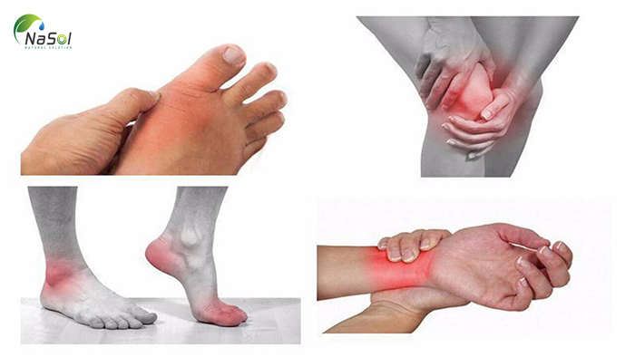 Levagen nghiên cứu lâm sàng trên viêm khớp