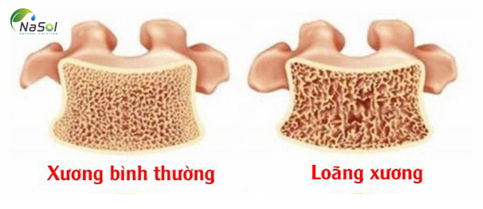 canxi và sức khỏe xương khớp
