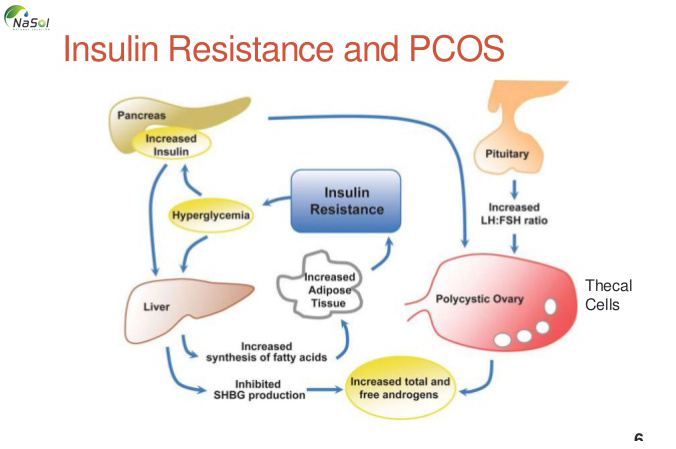Nguyên nhân buồng trứng đa nang