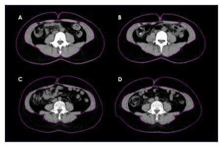 Nguyên liệu DNF-10