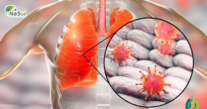 Tổn thương phổi do covid-19