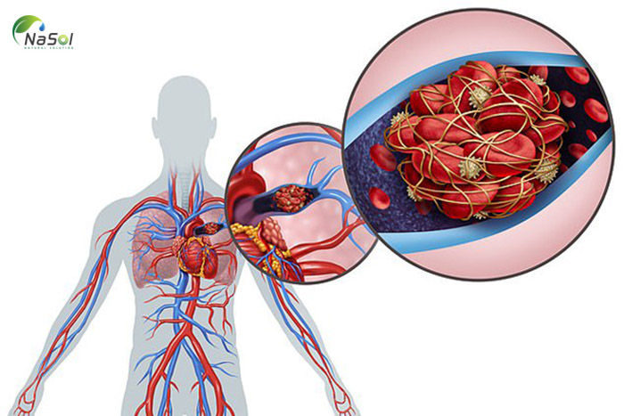 Tổn thương trên tim mạch do covid-19