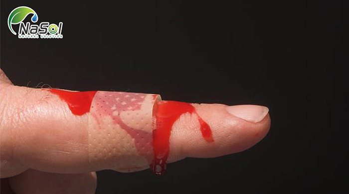 Tác dụng làm chậm quá trình đông máu của Nattokinase