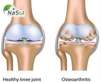 Công dụng và cơ chế hoạt động của Collagen type II từ sụn ức gà Công dụng và cơ chế hoạt động của Collagen type II từ sụn ức gà