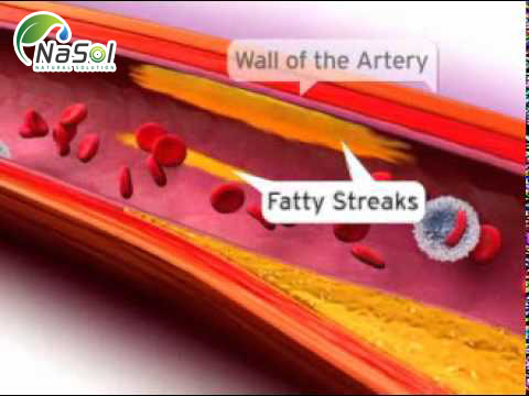 Gamma Oryzanol có thể ngăn ngừa xơ cứng động mạch (xơ vữa động mạch)