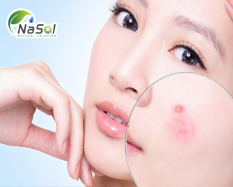 So sánh công dụng trên da của silymarine phytosome với acid retinoic So sánh công dụng trên da của silymarine phytosome với acid retinoic