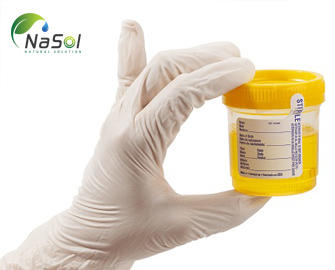 Tìm hiểu về chỉ số 8-OHdG  